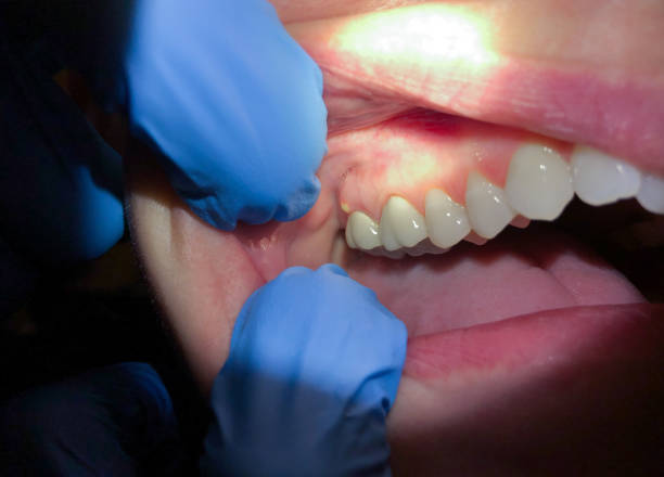 Best Broken or Chipped Tooth Repair in Fort Stockton, TX